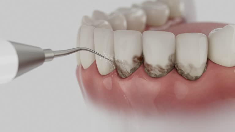 Trusted Root Canal Treatment service in Columbus, TX - Dentist Open Now